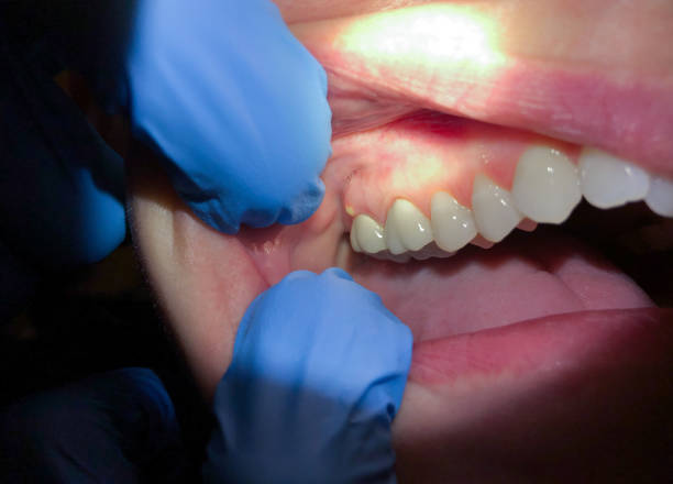 Best Emergency Dentist for Special Needs Patients in Essexville, MI