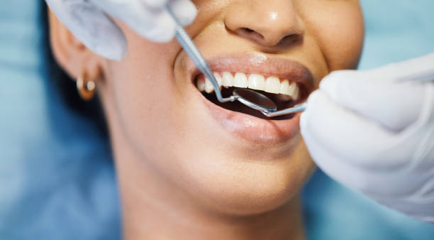 Best Emergency Dental Extractions in Essexville, MI